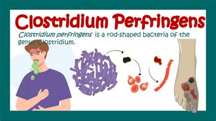 Clostridium - How To Discuss
